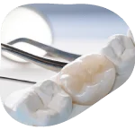 کلینیک دندانپزشکی دکتر شیرازی 40 کلینیک دندانپزشکی دکتر محمد محمدشیرازی - کلینیک دندانپزشکی دکتر شیرازی