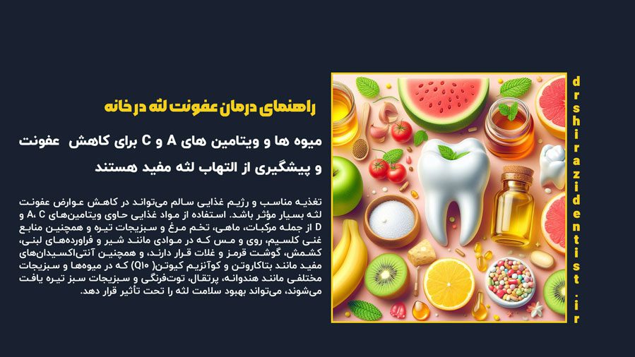 راهنمای درمان عفونت لثه در خانه 2 راهنمای درمان عفونت لثه در خانه