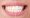 بلیچینگ دندان و تفاوت آن با سفید کردن دندان