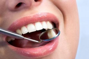 پوسیدگی دندان و راه های مقابله با آن 3 پوسیدگی دندان