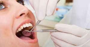 مراقبت های بعد از جراحی پریودنتال