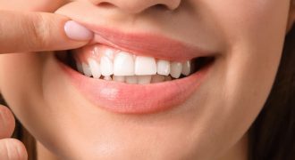 تاثیر استرس بر سلامت دهان و دندان