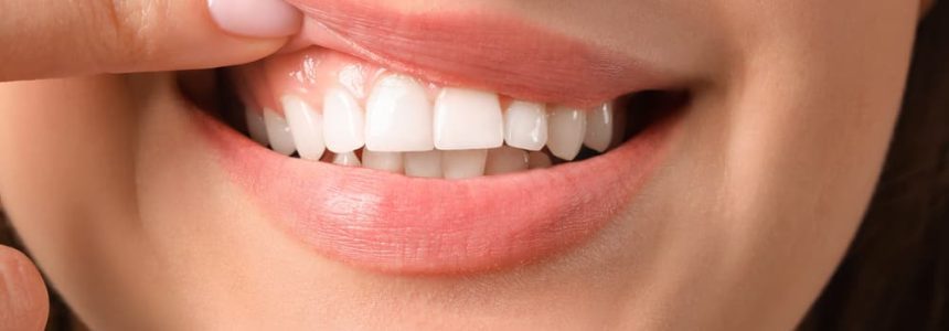 تاثیر استرس بر سلامت دهان و دندان