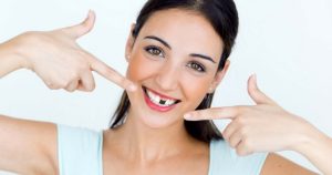 انواع دندان های غایب در کم دندانی